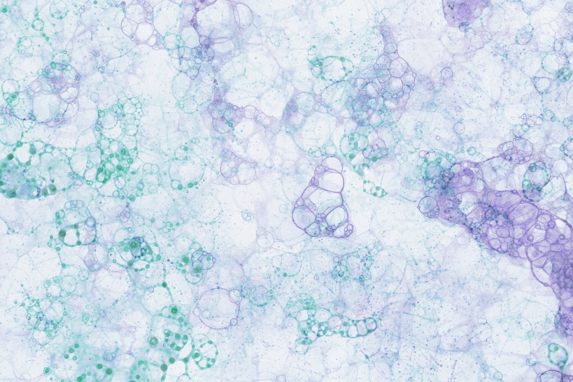 フッ素樹脂にはPTFE以外の種類